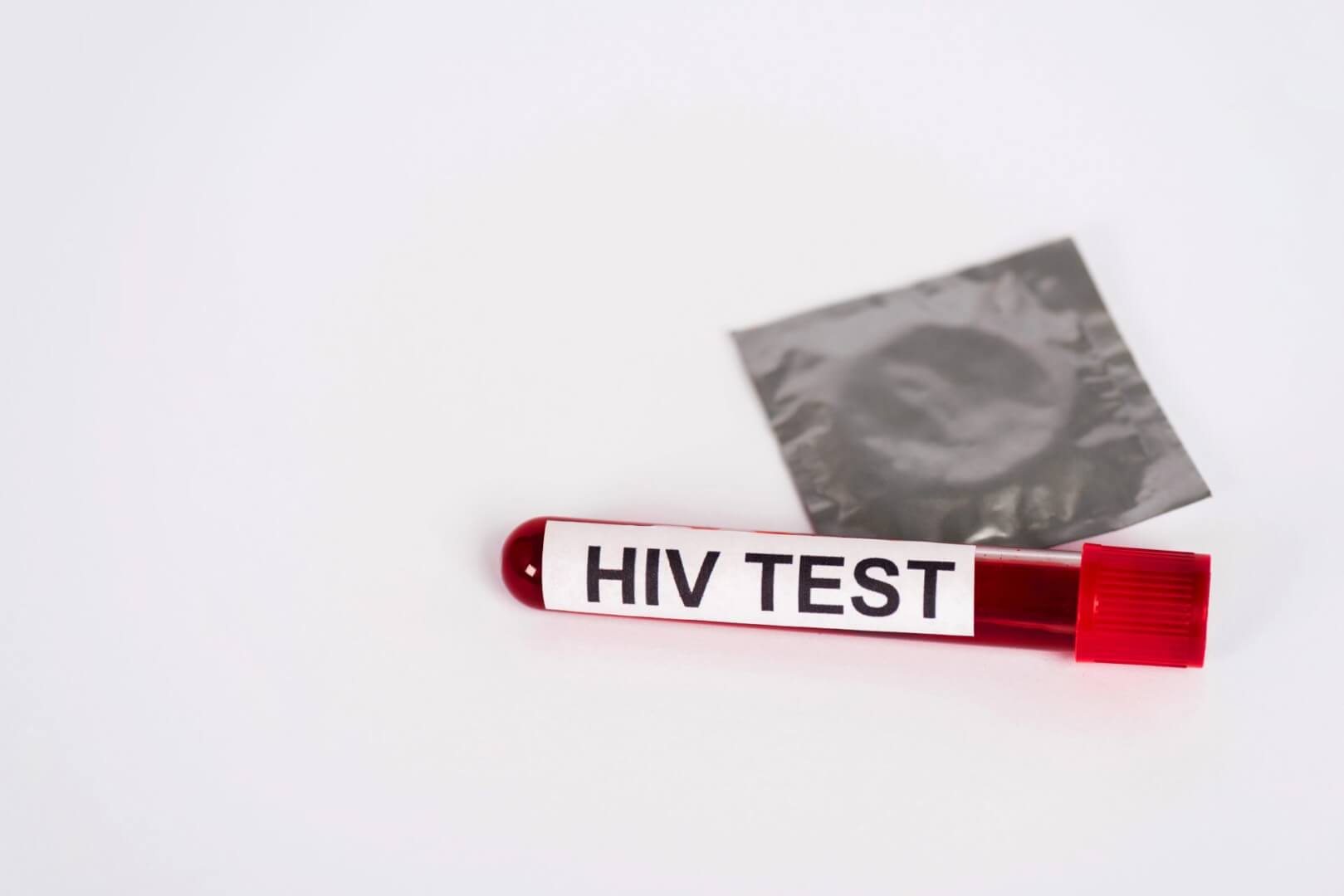 HIV + ou HIV-?